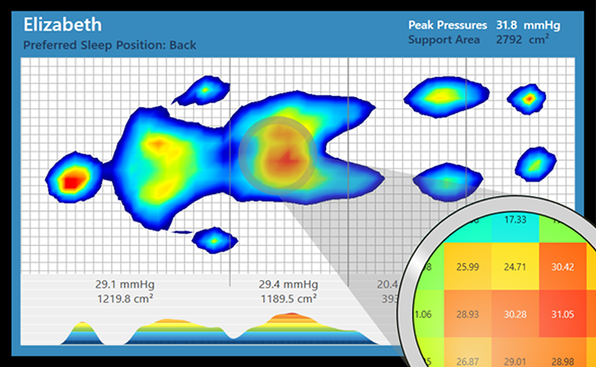 Heat map of a person lying on their back with pressure distribution, showing peak pressures and support areas.